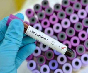 Coronavirus: More than one crore 81 lakh infected patients of Corona virus across the country