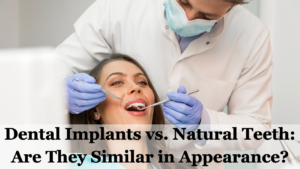 Dental Implants