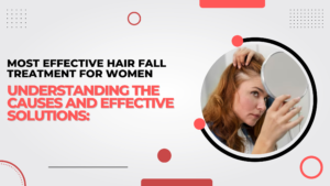 Most Effective Hair Fall Treatment for Women: Understanding the Causes and Effective Solutions: